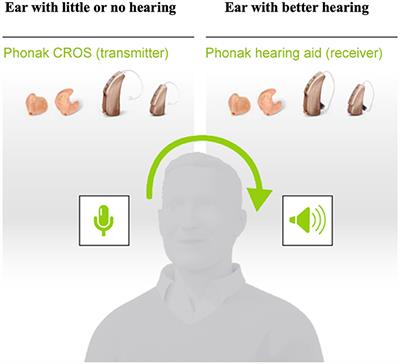 Device-based interventions that seek to restore bilateral and binaural hearing in adults with single-sided deafness: a conceptual analysis